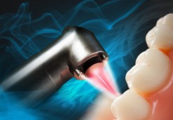 Dental laser - Osovnikar Dentists OZ 95'