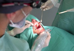 Oralna kirurgija - Osovnikar zobozdravniki OZ 95'