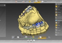 Cerec 3D protetika - Osovnikar zobozdravniki OZ 95'