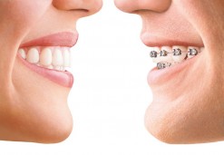 Ortodontija - Osovnikar zobozdravniki OZ 95
