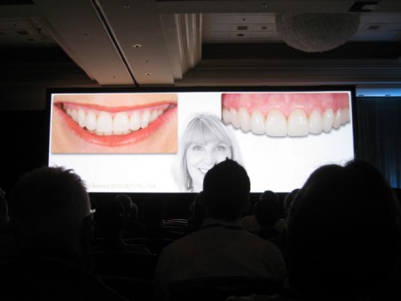 Kongres o estetskem zobozdravstvu - San Diego