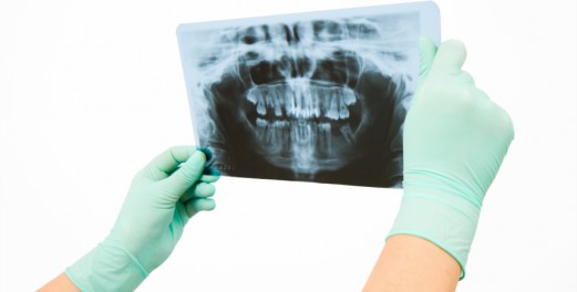 Zobni rentgen (digitalni zobni rentgen - ortopansko slikanje zob)