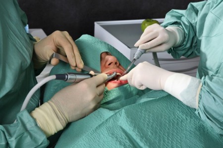 Oralna kirurgija