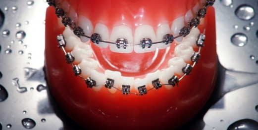 ORTHODONTICS for children or adults - in our clinic!