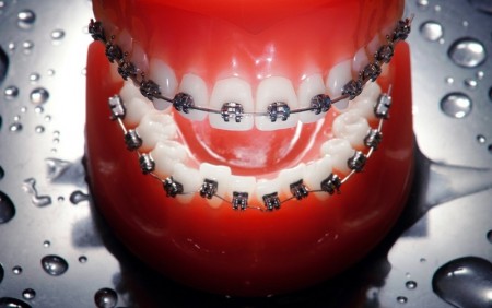 Ortodontija za otroke in odrasle