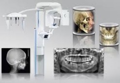 Zobni rentgen 3D CBCT