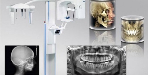 Izobraževanja za zobozdravnike - Uporaba CBCT posnetkov v zobozdravstvu